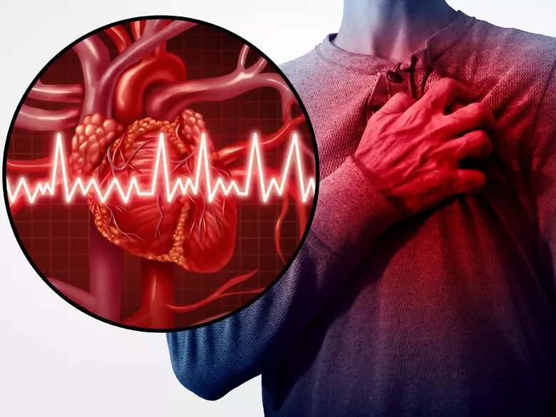 W jaki sposób narzędzie AI pomaga w diagnozowaniu zawału serca?