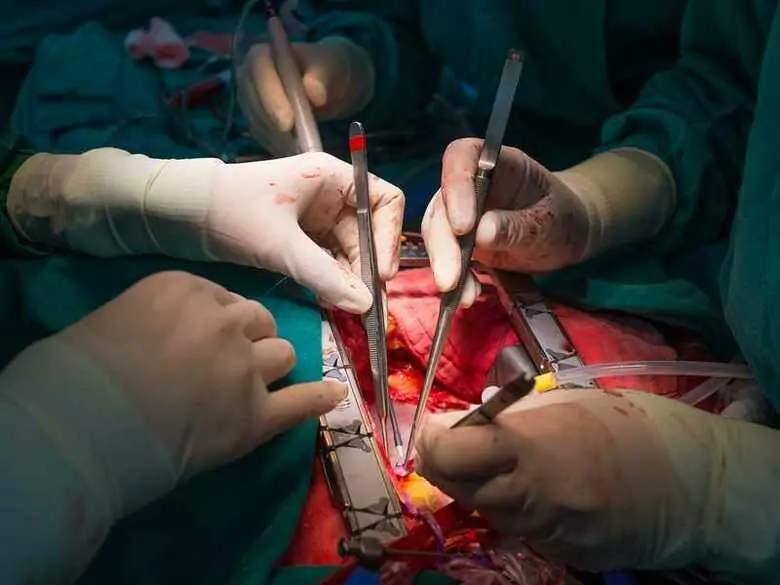 37 lat od pierwszego udanego przeszczepu serca w Polsce