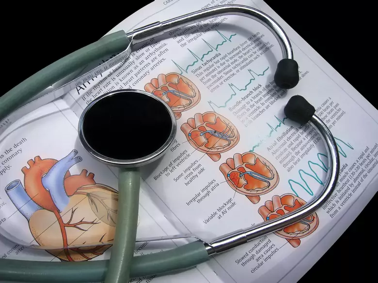 Najczęstsze choroby serca i sposoby ich leczenia