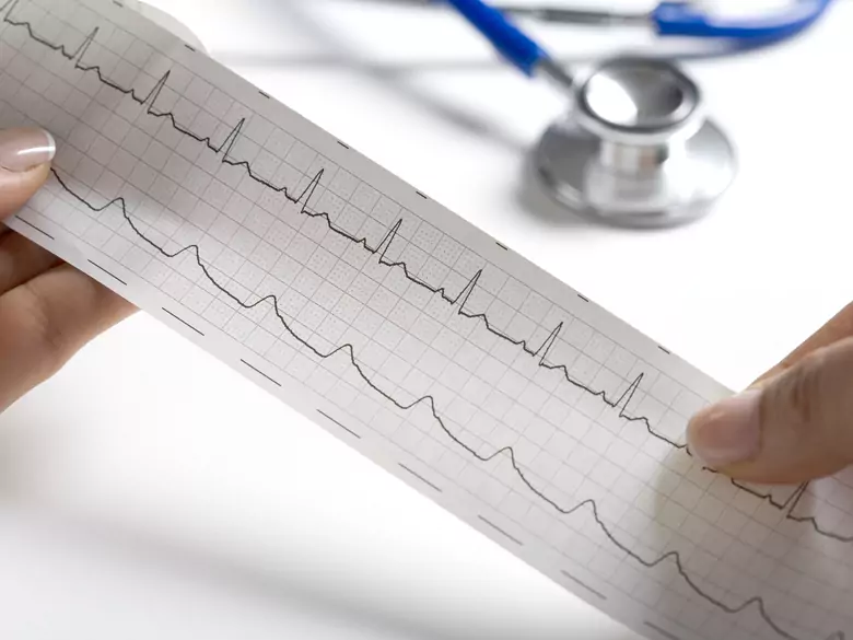 Niewydolność serca