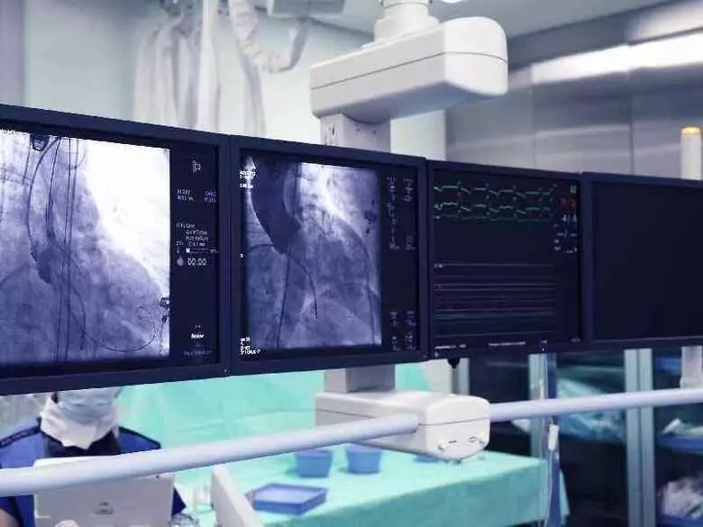 Jakie korzyści przynosi rewaskularyzacja naczyń wieńcowych?